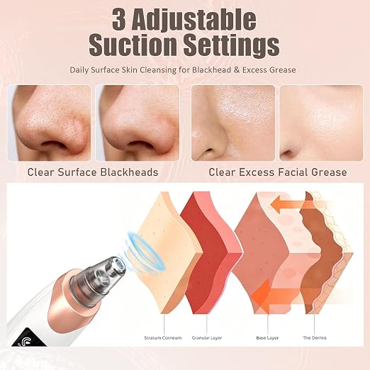 Blackhead Remover Pore Vacuum,Facial Pore Cleaner-3 Suction Power,USB Rechargeable Blackhead Vacuum Kit Electric Pore Vacuum Tool for Ad(free home delivery)